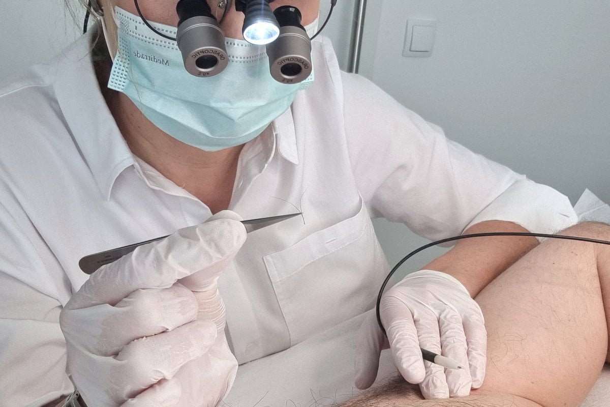 Epilation